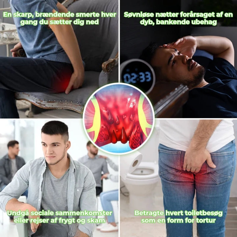 HaemoLind ™- Hurtig lindrende urtespray mod hæmorider