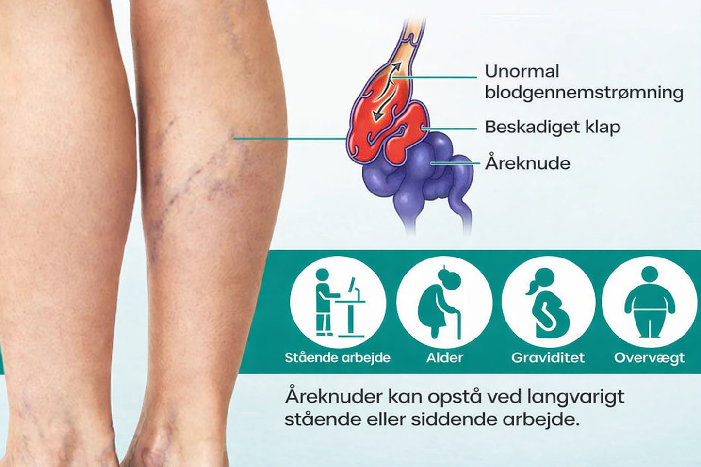 VenaLindre™ – Micronåle-patch til støtte for vener og lindring af tunge ben