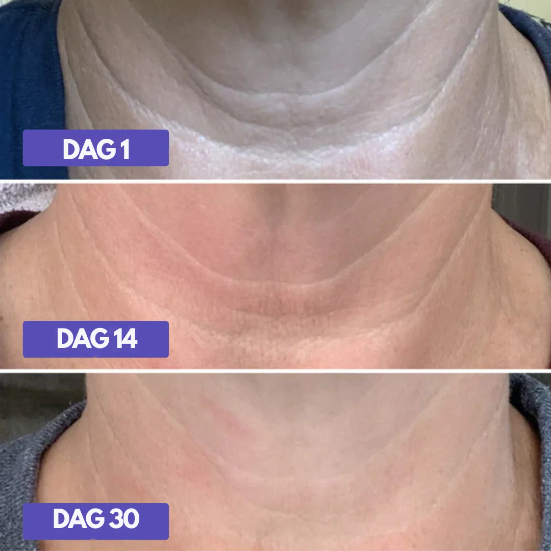 HalsLøft™ – Opstrammende Hals- & Dekolletagecreme