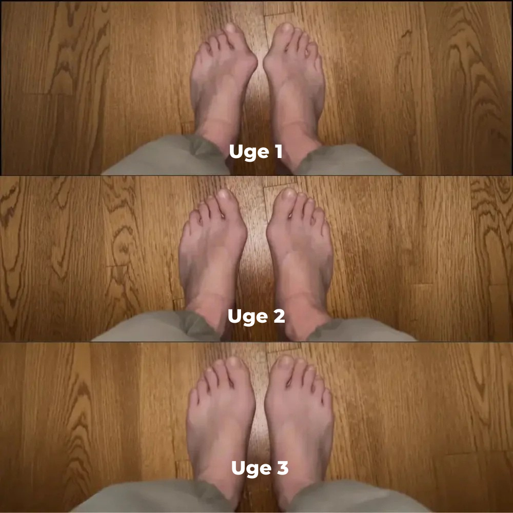 FodKorrekt™ | Genskab din fods naturlige balance – helt uden indgreb