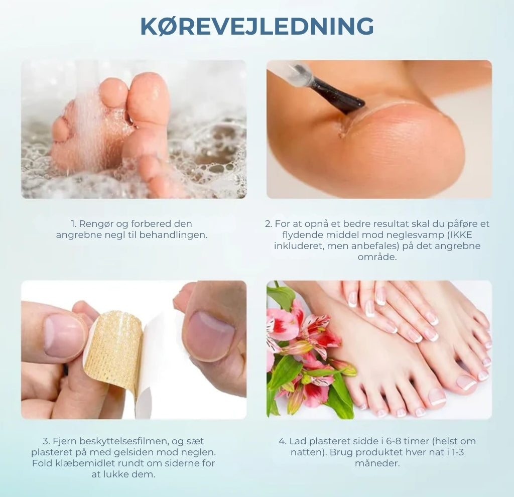 NegleFix™ – Svampedræbende Negleplaster til Sundere Negle