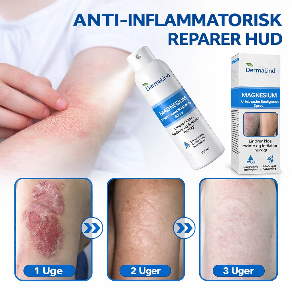 DermaLind™ - Magnesium Hudreparerende Spray til Sensitiv og Irriteret Hud