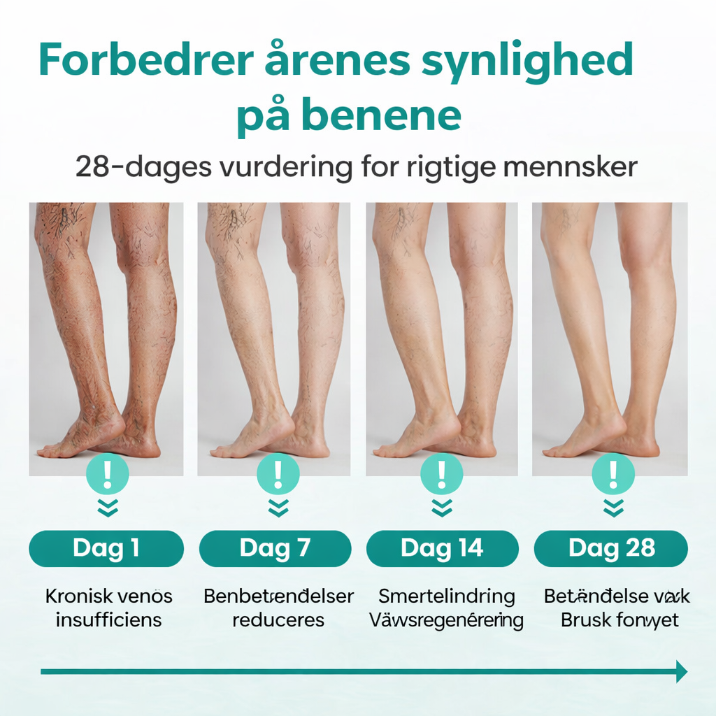 VenaLindre™ – Micronåle-patch til støtte for vener og lindring af tunge ben