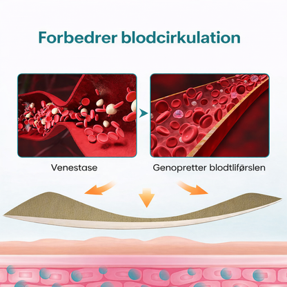 VenaLindre™ – Micronåle-patch til støtte for vener og lindring af tunge ben