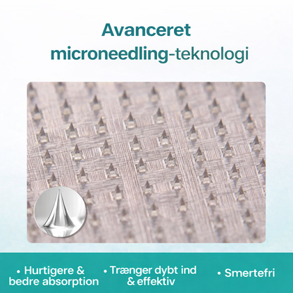 VenaLindre™ – Micronåle-patch til støtte for vener og lindring af tunge ben