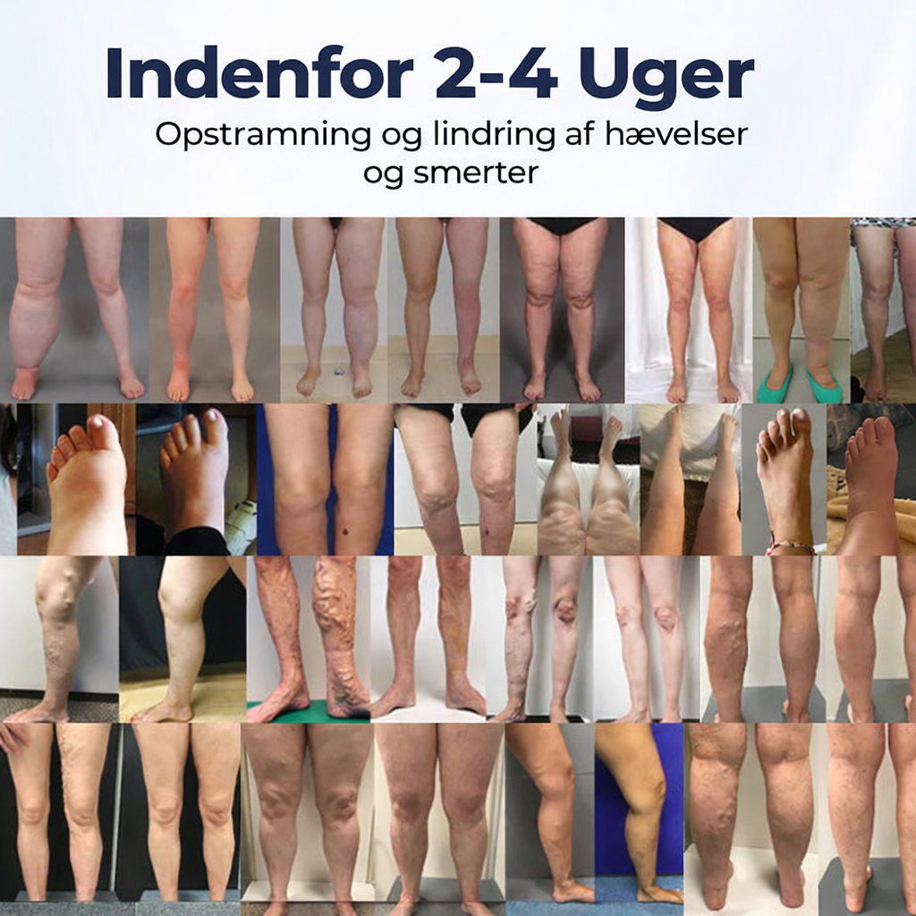 BenRo™ – Lindrende bencreme til lette ben og bedre blodcirkulation