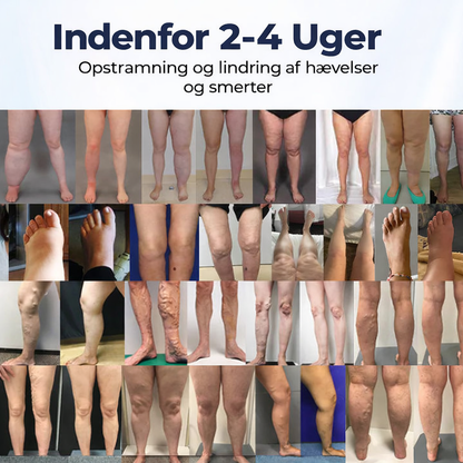 BenRo™ – Lindrende bencreme til lette ben og bedre blodcirkulation