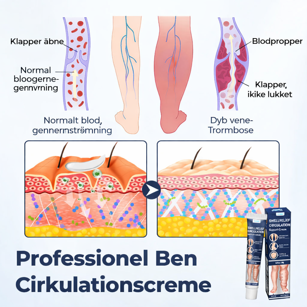 BenRo™ – Lindrende bencreme til lette ben og bedre blodcirkulation