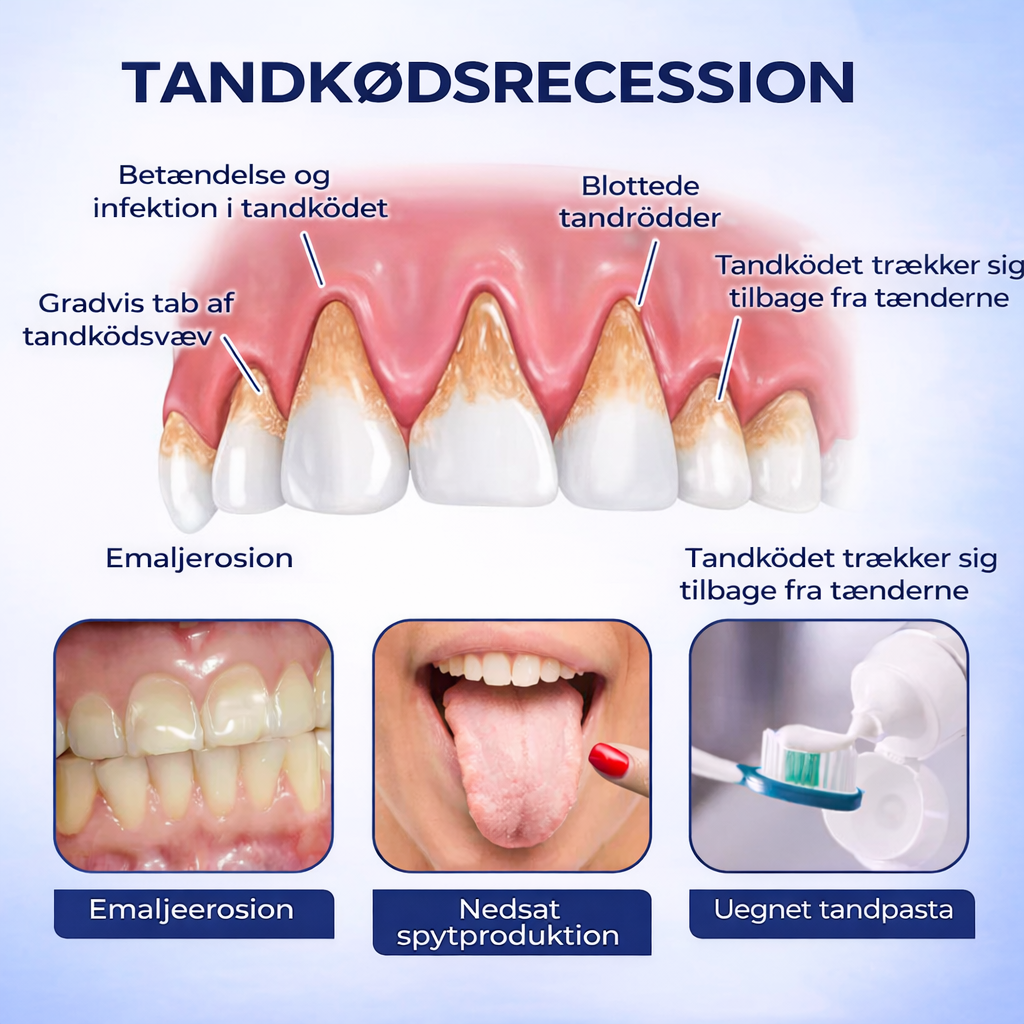 TandKraft™ – Tand- & Tandkødsstyrke