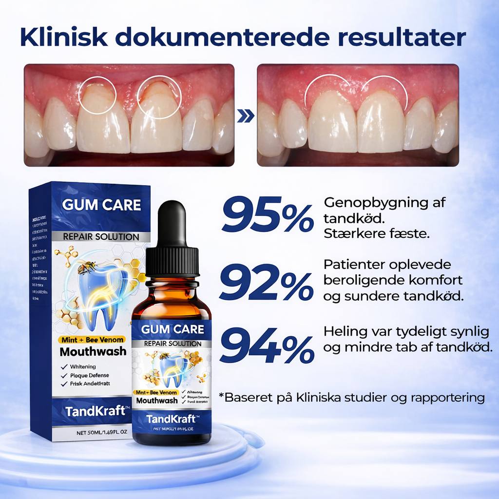 TandKraft™ – Tand- & Tandkødsstyrke