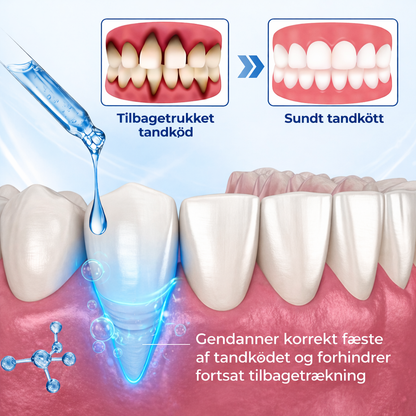 TandKraft™ – Tand- & Tandkødsstyrke