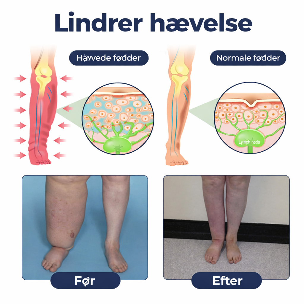BenRo™ – Lindrende bencreme til lette ben og bedre blodcirkulation