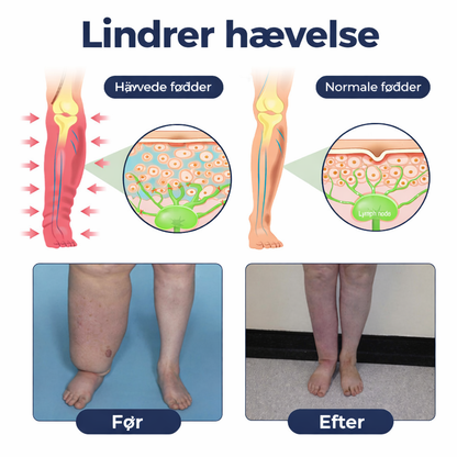 BenRo™ – Lindrende bencreme til lette ben og bedre blodcirkulation