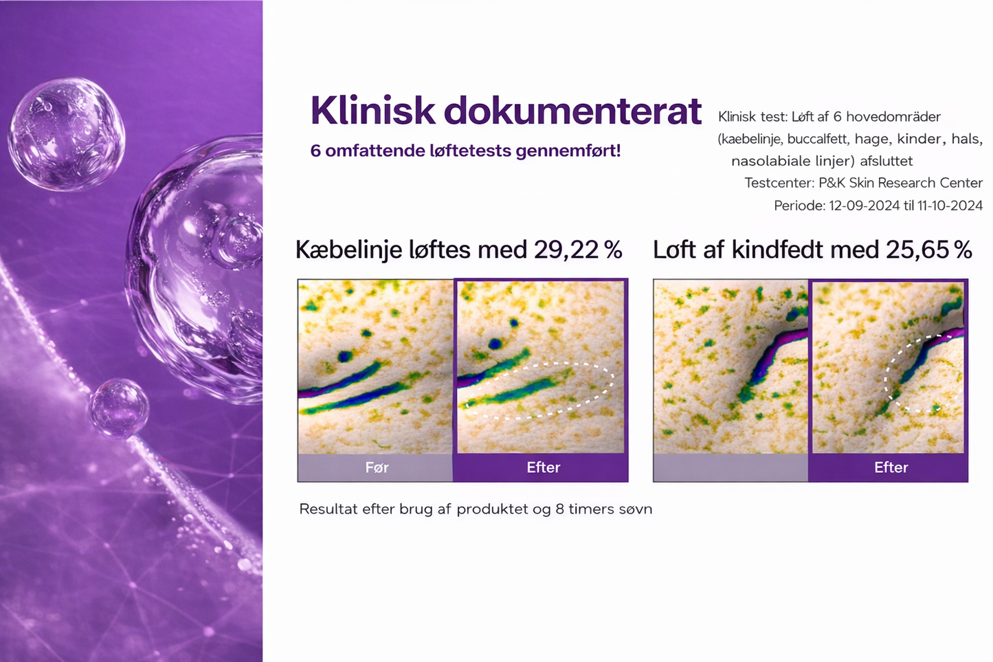 HudKlar™ – NAD+ Løfteserum & Maske