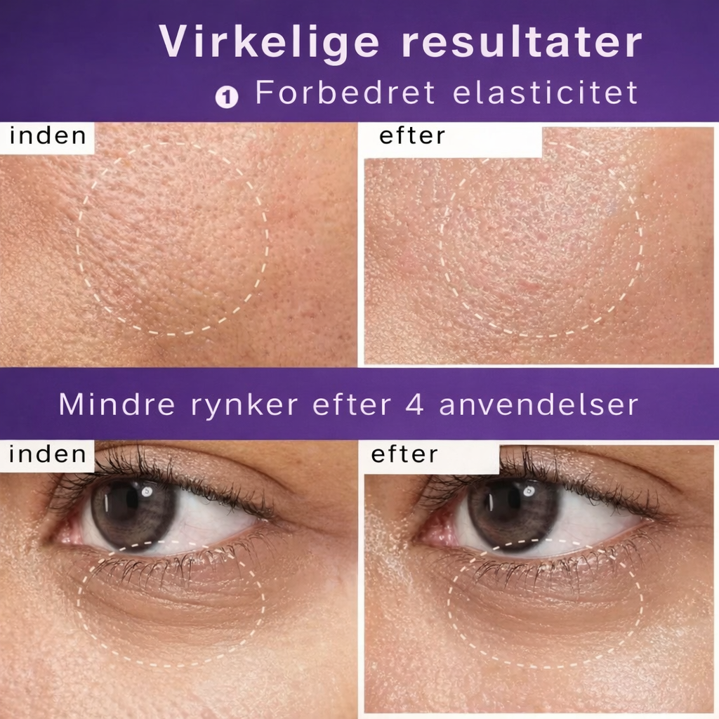 HudKlar™ – NAD+ Løfteserum & Maske