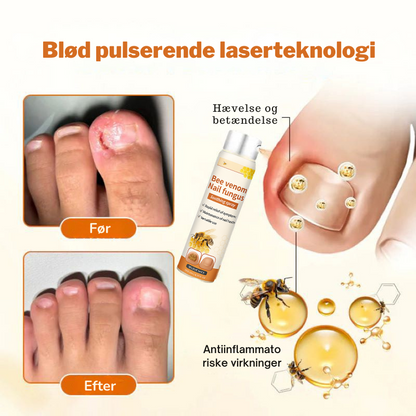 KlarNegl™ – Avanceret Svampedræbende Negleplejespray