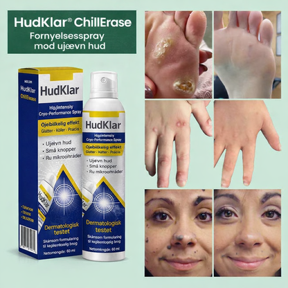 HudKlar™ ChillErase – Præcis kølende spray til glattere hud